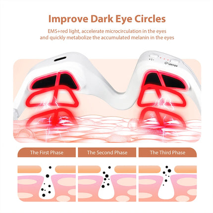 Eye Massager for Wrinkle Removal, Dark Circles, and Eye Bag Reduction – Relieve Eye Fatigue with this Eye Care Beauty Device